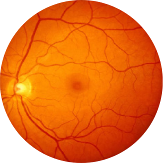 Fundus photograph of a healthy eye